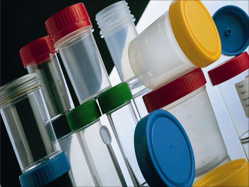 забор биоматериала